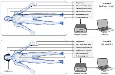 Evaluation of an Objective Measurement Tool for Stress Level Reduction by Individually Chosen Music During Colonoscopy—Results From the Study “ColoRelaxTone”